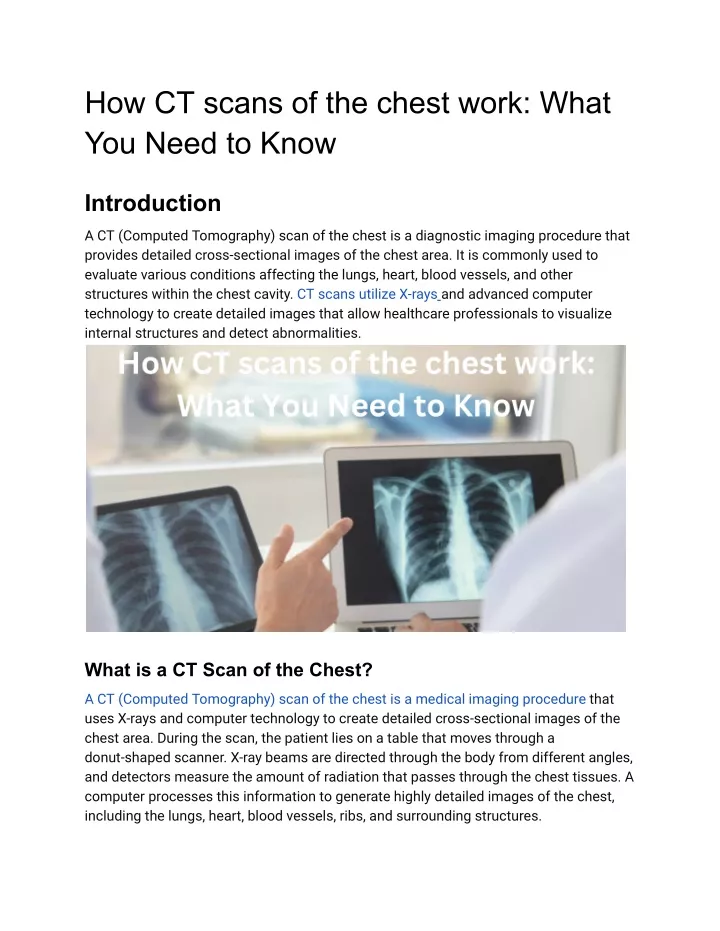 how ct scans of the chest work what you need