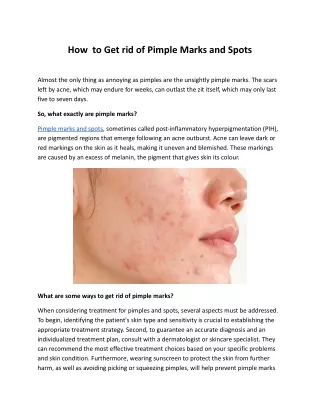 How  to Get rid of Pimple Marks and Spots
