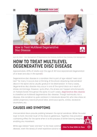 How to Treat Multilevel Degenerative Disc Disease