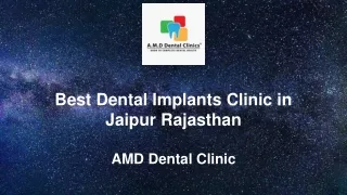 Best Dental Implants Clinic in Jaipur Rajasthan
