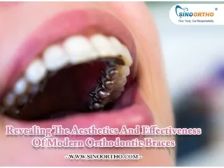 Revealing The Aesthetics And Effectiveness Of Modern Orthodontic Braces