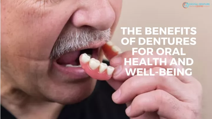 the benefits of dentures for oral health and well
