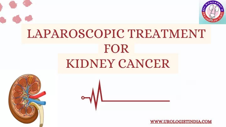 laparoscopic treatment for kidney cancer