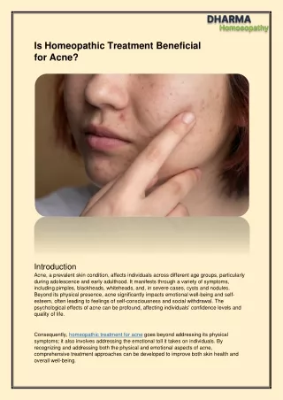 Is Homeopathic Treatment Beneficial for Acne