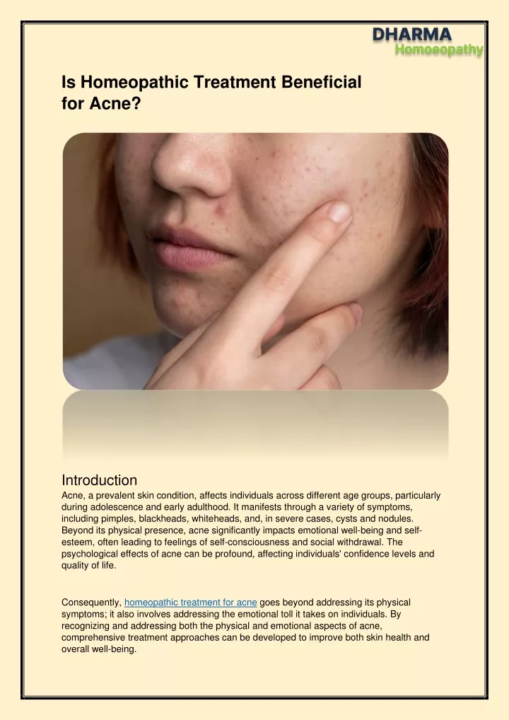 is homeopathic treatment beneficial for acne