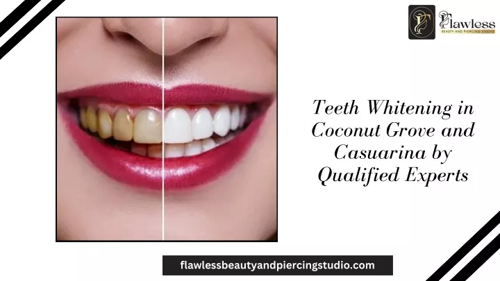 teeth whitening in coconut grove and casuarina