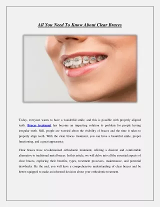 All You Need to Know about Clear Braces