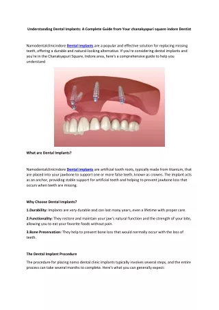 Understanding Dental Implants A Complete Guide from Your chanakyapuri square indore Dentist