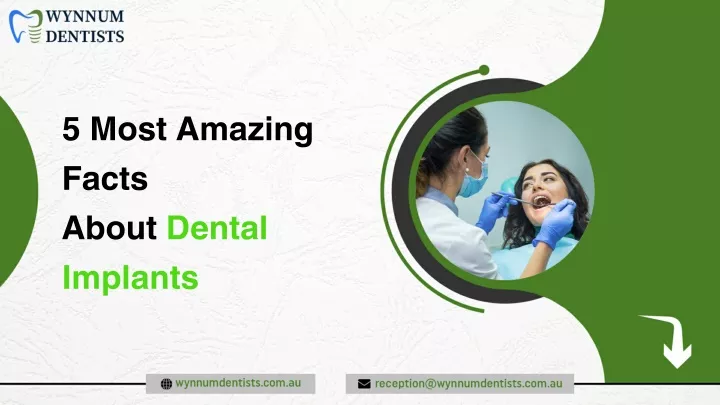 5 most amazing facts about dental implants