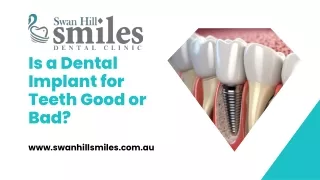 Is a Dental Implant for Teeth Good or Bad