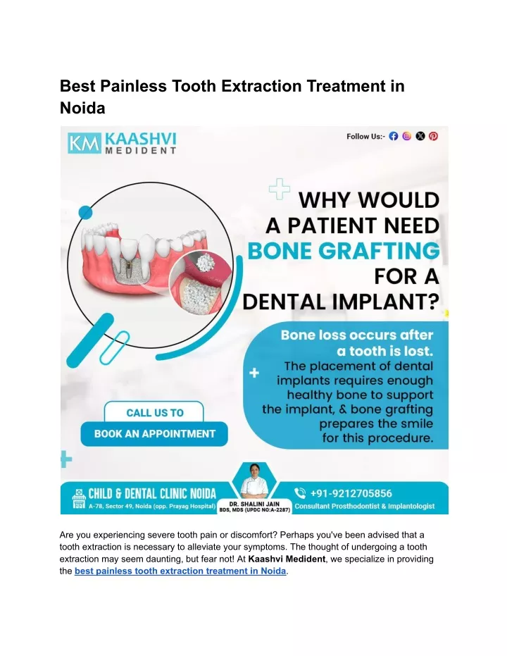 best painless tooth extraction treatment in noida