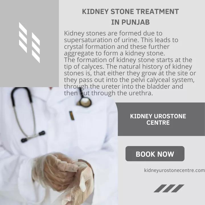 kidney stone treatment in punjab kidney stones