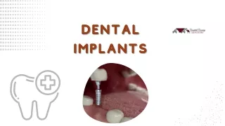 What are dental implants