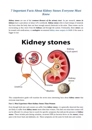 7 Important Facts About Kidney Stones Everyone Must Know