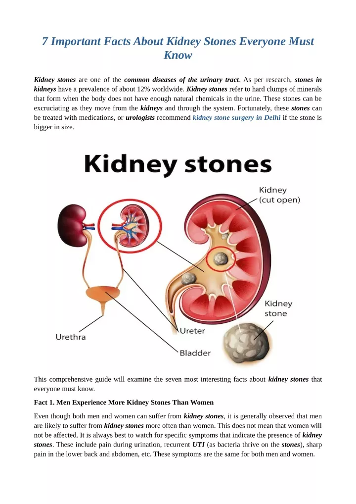 7 important facts about kidney stones everyone