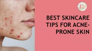 Best skincare tips for acne-prone skin