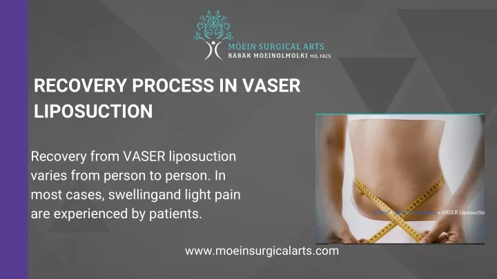 recovery process in vaser liposuction