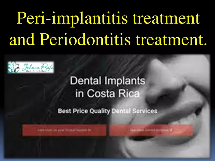 peri implantitis treatment and periodontitis