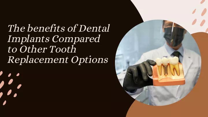 the benefits of dental implants compared to other