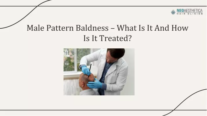 male pattern baldness what is it and how is it treated