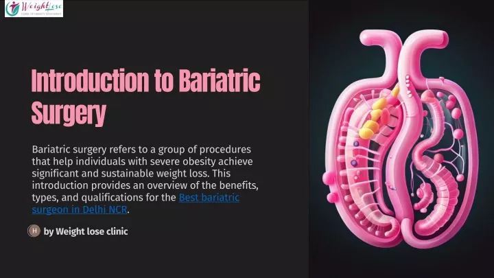 introduction to bariatric surgery