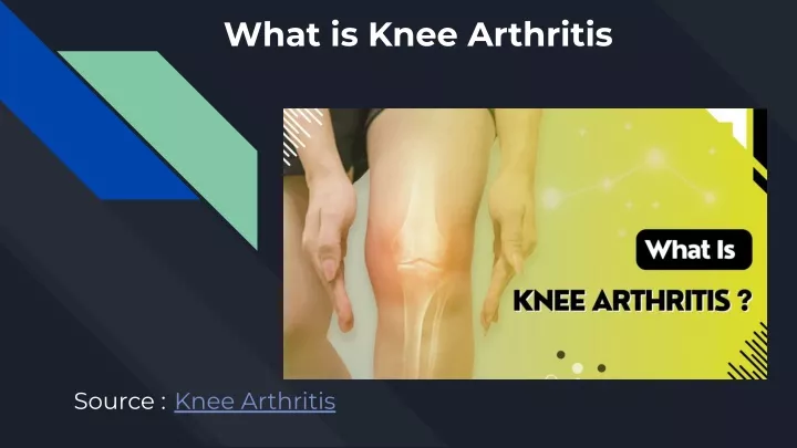 what is knee arthritis