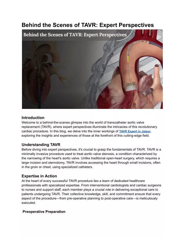 behind the scenes of tavr expert perspectives