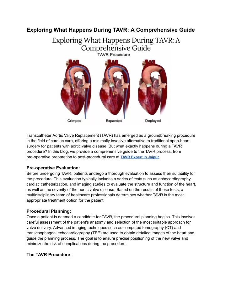 exploring what happens during tavr