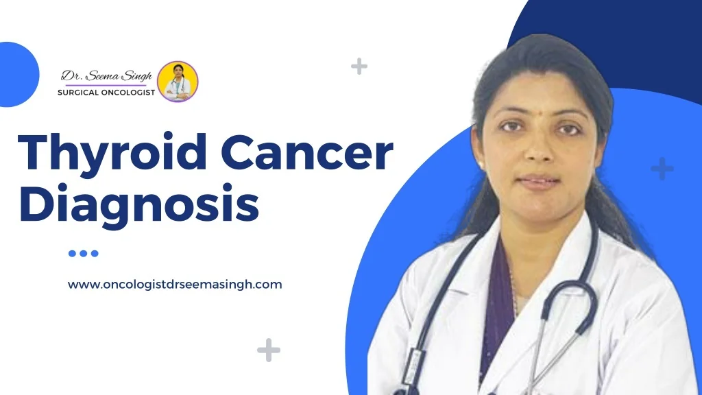PPT - Thyroid Cancer Diagnosis PowerPoint Presentation, free download ...