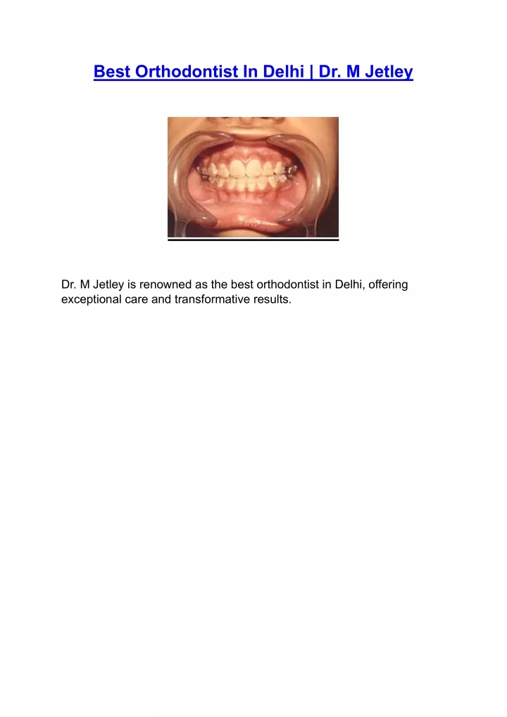 best orthodontist in delhi dr m jetley