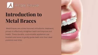 Introduction to Metal Braces