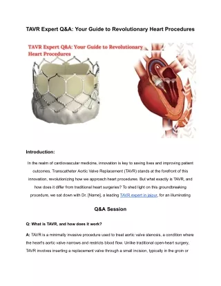 TAVR Expert Q&A_ Your Guide to Revolutionary Heart Procedures