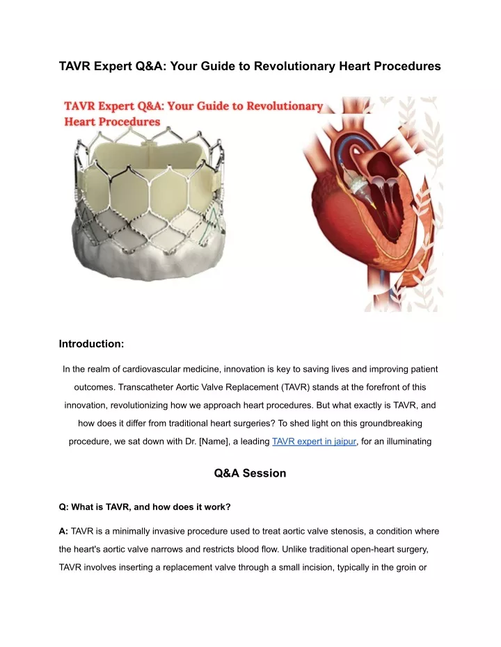 tavr expert q a your guide to revolutionary heart