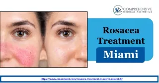 ransform Your Skin with Expert Rosacea Treatment in Miami with Us!