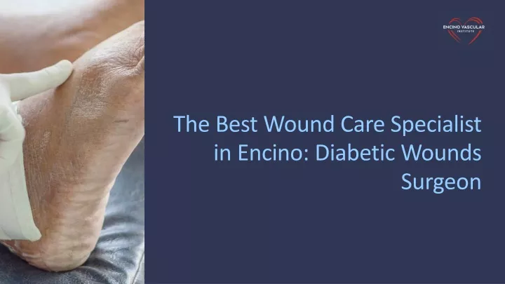 the best wound care specialist in encino diabetic