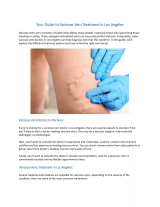 Your Guide to Varicose Vein Treatment in Los Angeles
