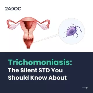 Trichomoniasis- Understanding Treatment and Prevention