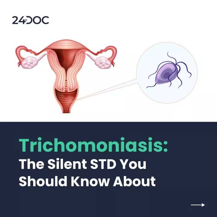 trichomoniasis the silent std you should know