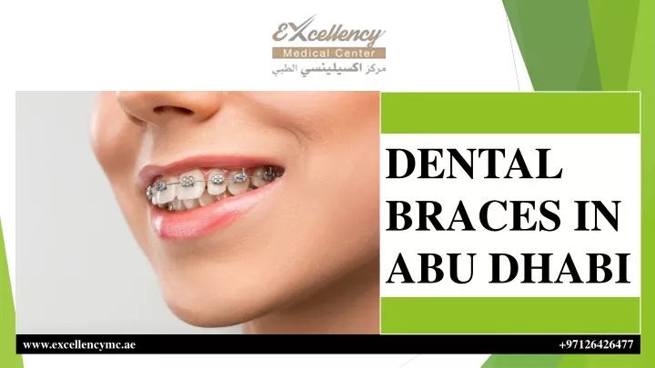 dental braces in abu dhabi