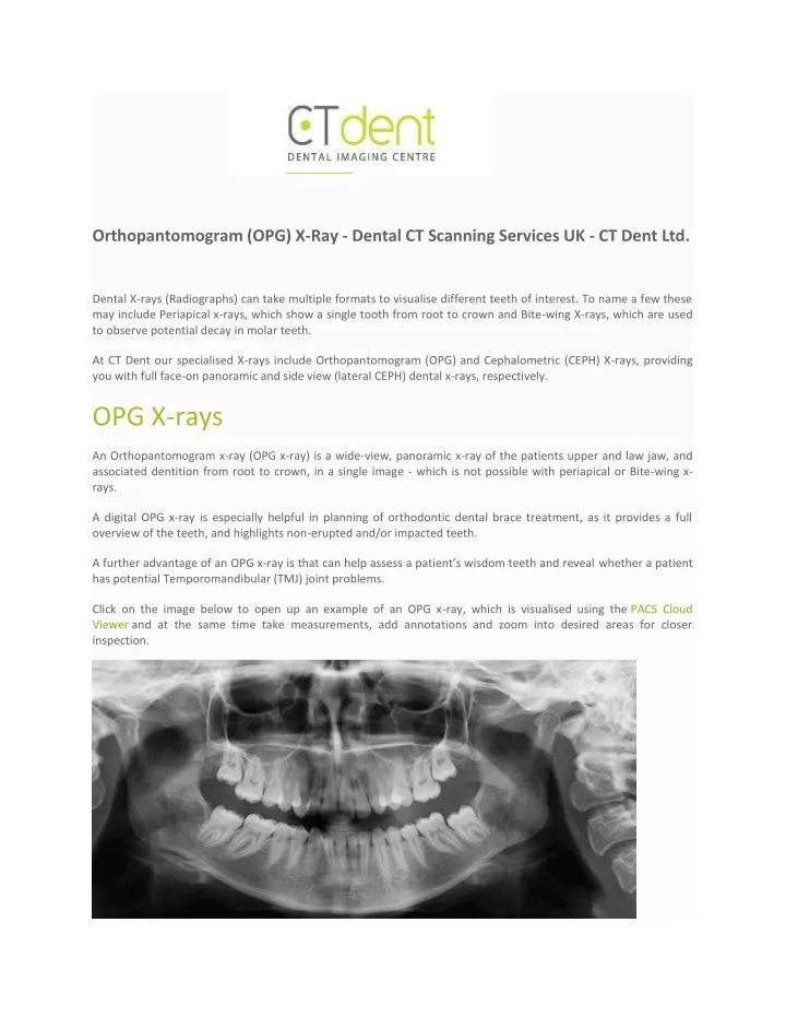 orthopantomogram opg x ray dental ct scanning