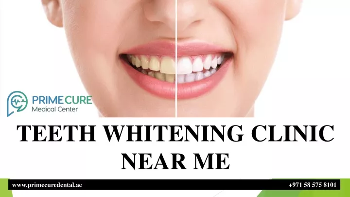 teeth whitening clinic near me