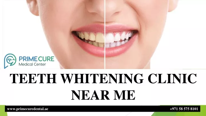 teeth whitening clinic near me