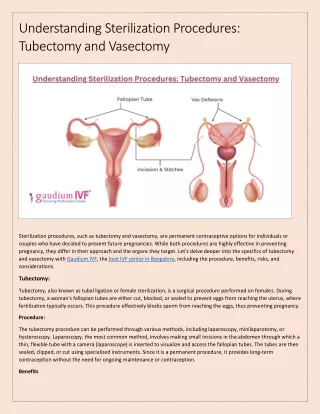 Understanding Sterilization Procedures: Tubectomy and Vasectomy