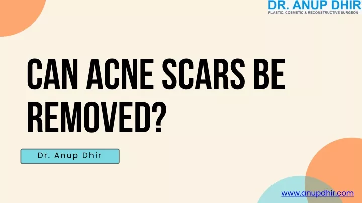 can acne scars be removed