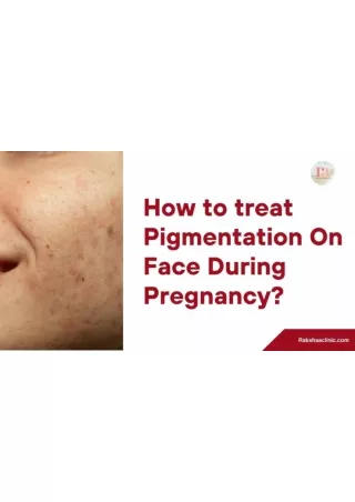 best pigmentation treatment in delhi