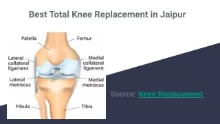 Best Total Knee Replacement in Jaipur