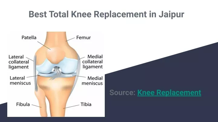 best total knee replacement in jaipur