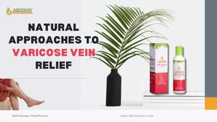 natural approaches to varicose vein relief