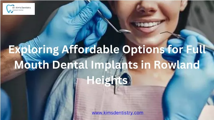 exploring affordable options for full mouth