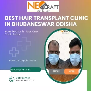 Best Hair Transplant Clinic in Bhubaneswar Odisha